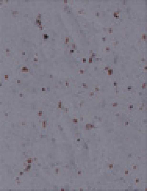 Lenkerband Cinelli CORK