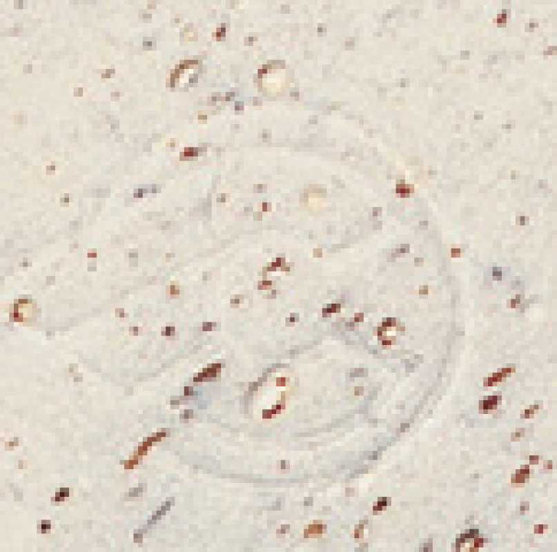 Lenkerband Cinelli CORK GEL